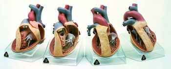 OS 7 Modellserie mit der Darstellung angeborener Herzfehler