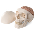 Schädel mit Gehirn, 8-teilig – 3B Smart Anatomy