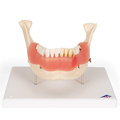 Zahnerkrankung, 2-fache Größe, 21-teilig – 3B Smart Anatomy
